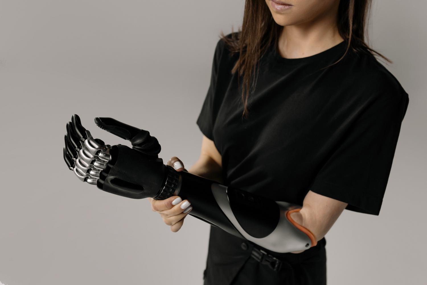 Primer plano de un brazo biónico con tecnología avanzada, representando el soporte y las mejoras